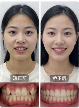 Orthodontics