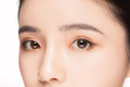 Rhinoplasty