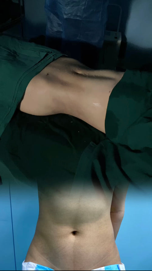 Big buttocks