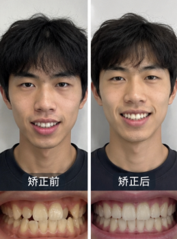 Orthodontics