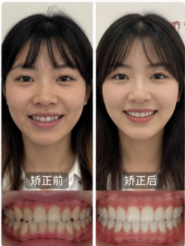 Orthodontics